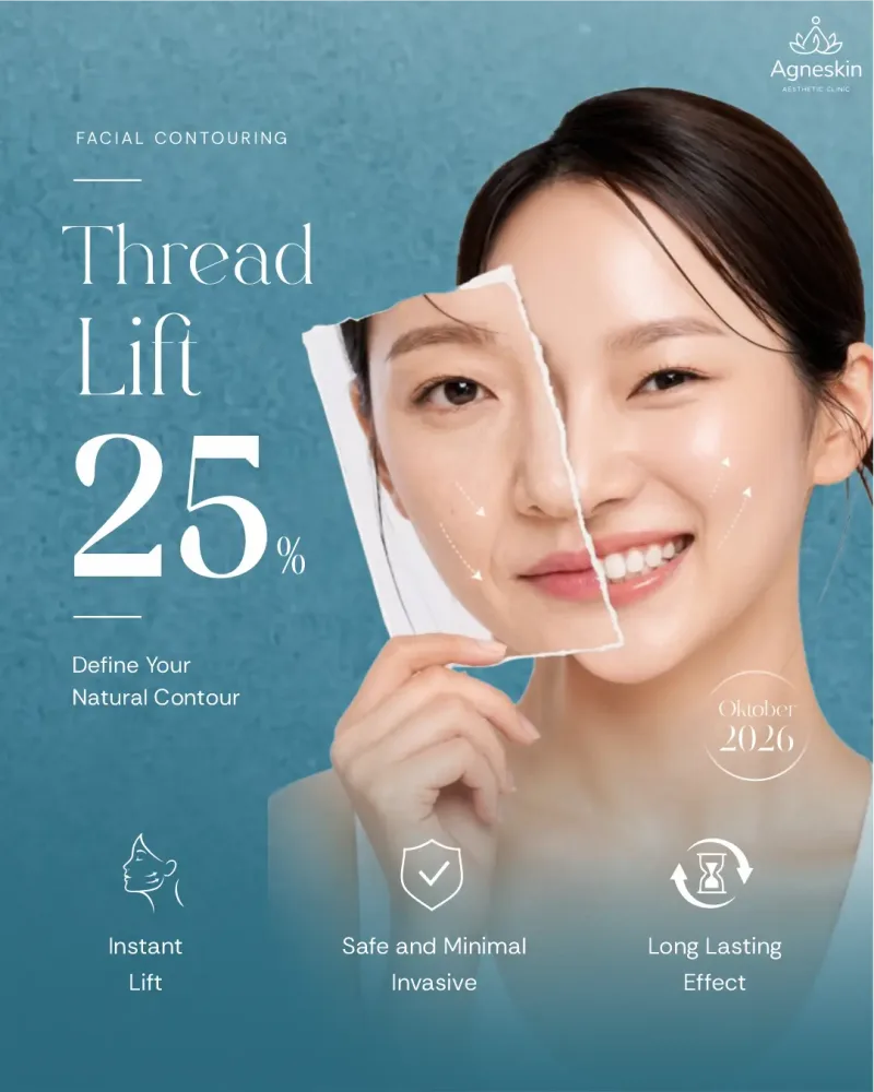 Promo Banjarmasin: diskon 25% Thread Lift