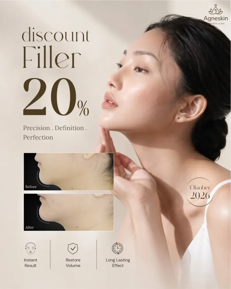 Promo Banjarmasin: diskon 20% Filler