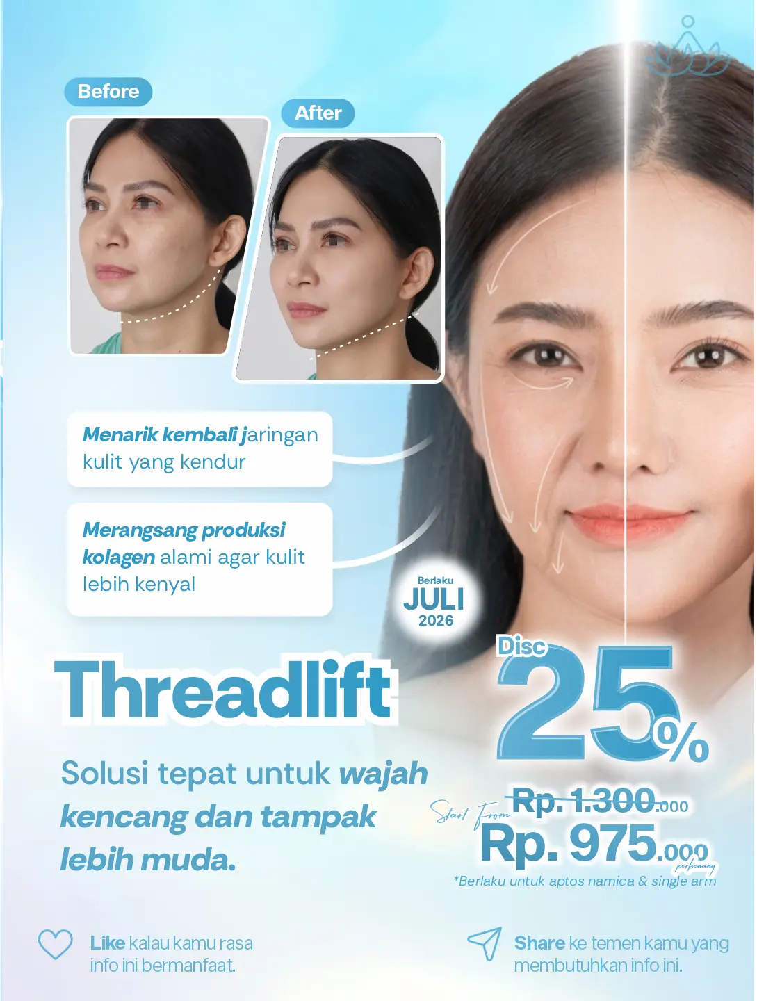 Promo Threadlift