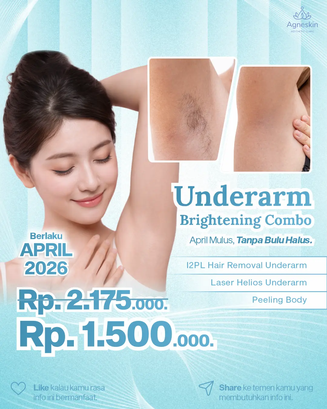 Promo Underarm Treatment