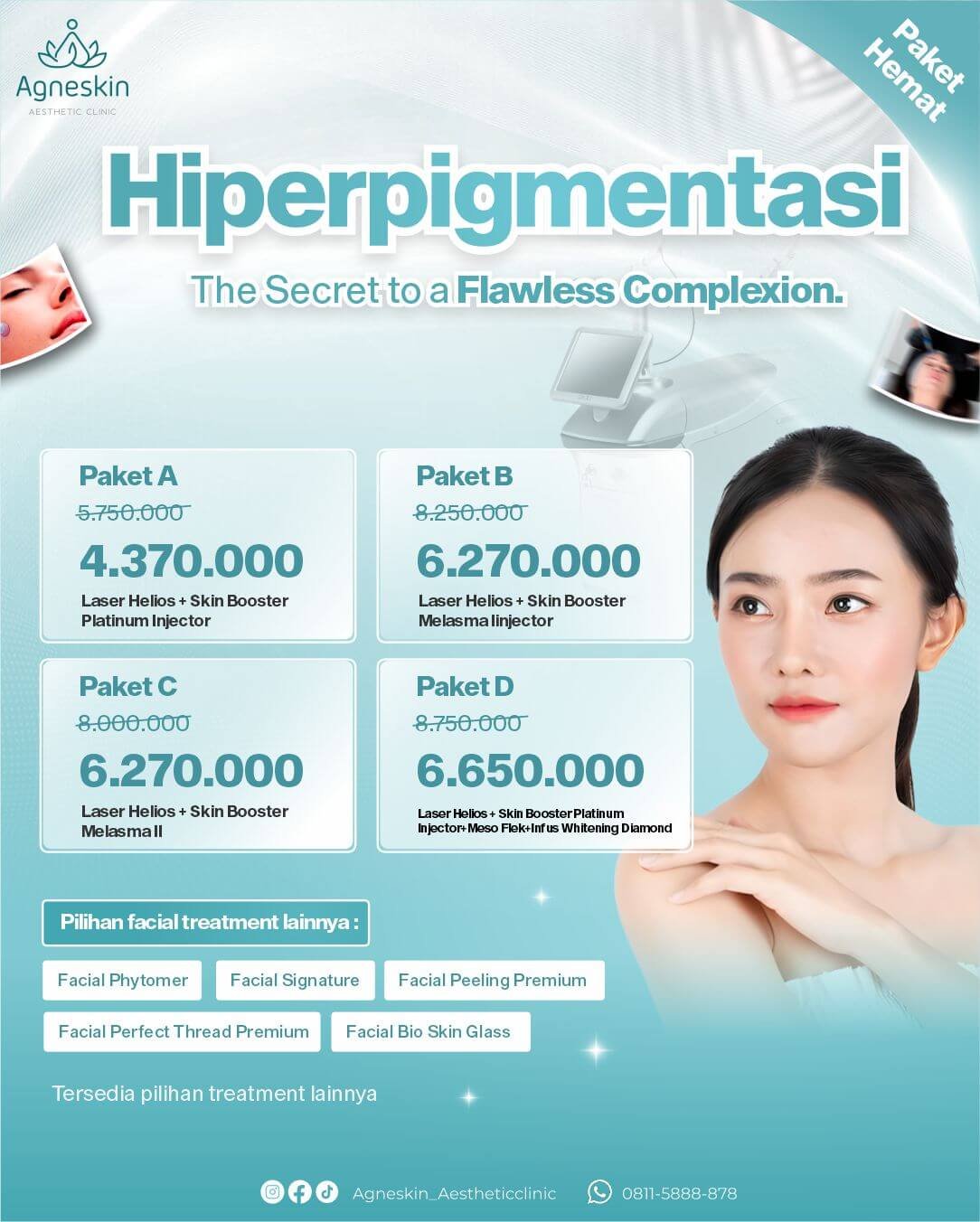 Hiperpigmentasi Promo