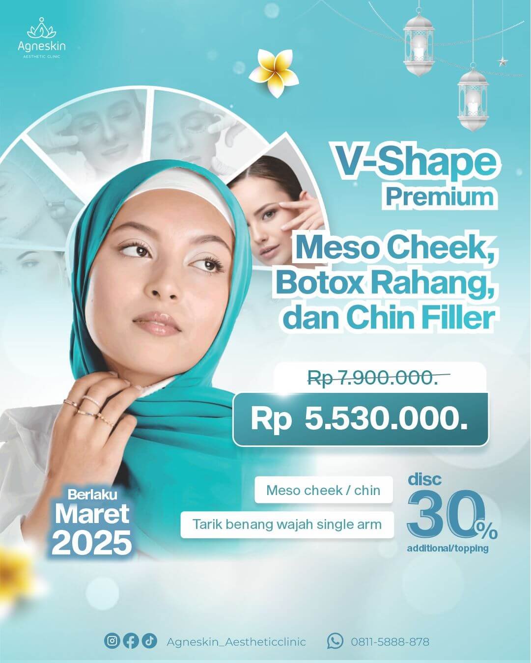 Promo V Shape Premium (1)