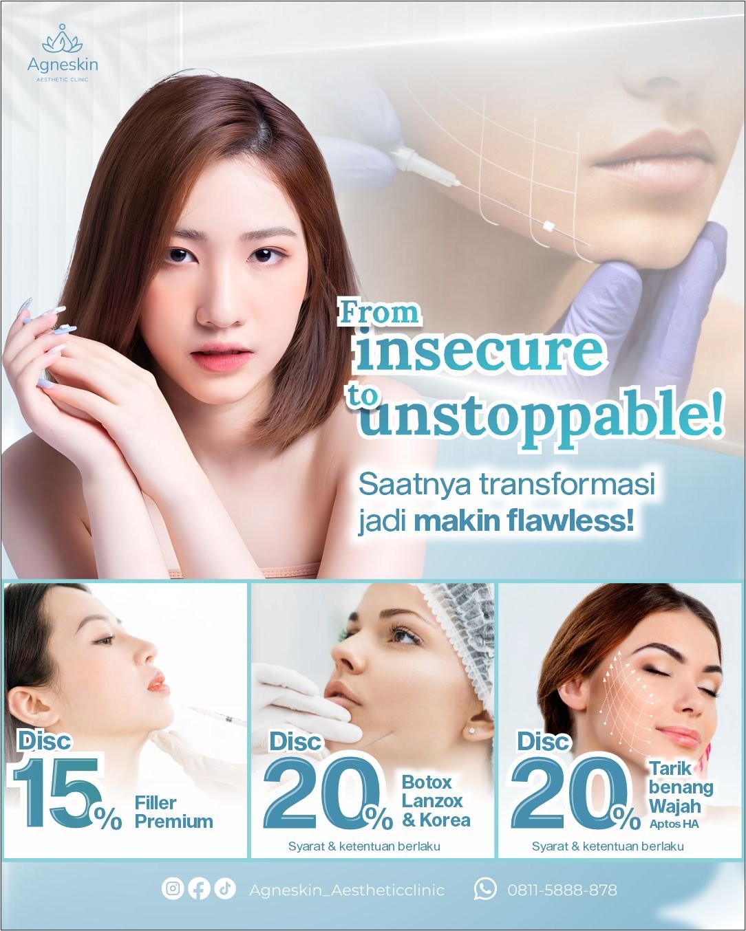 botox filler