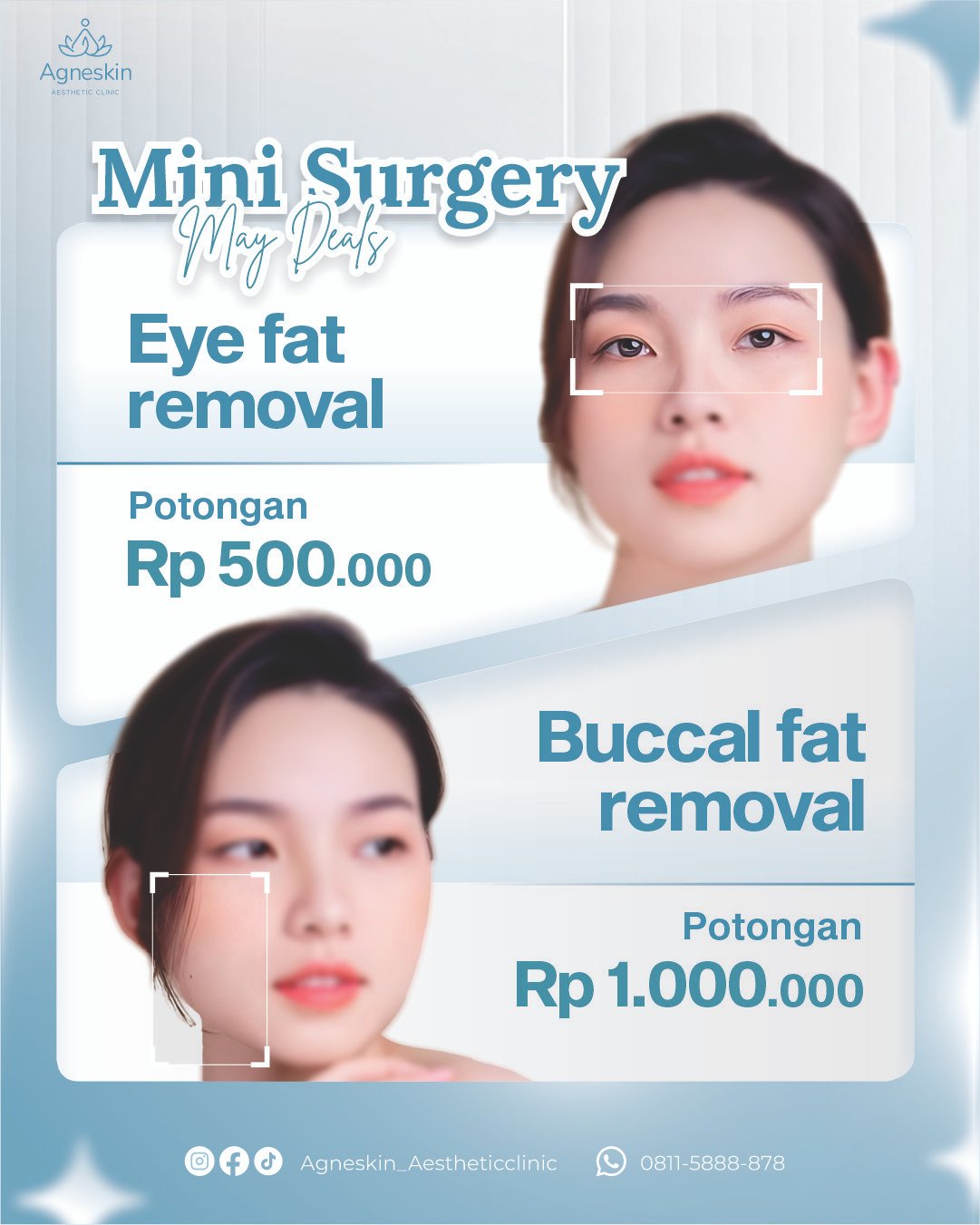 mini surgery