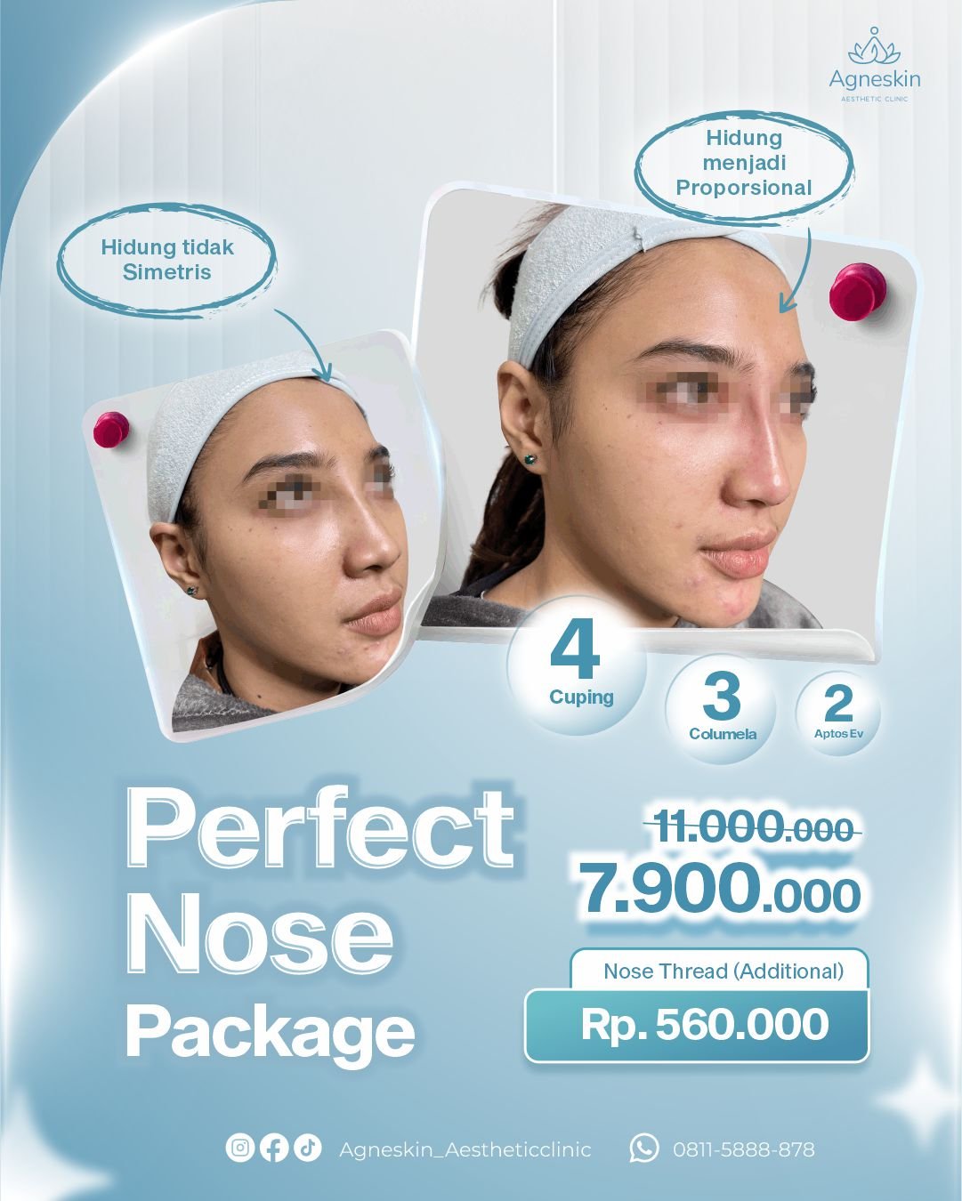 perfect nose