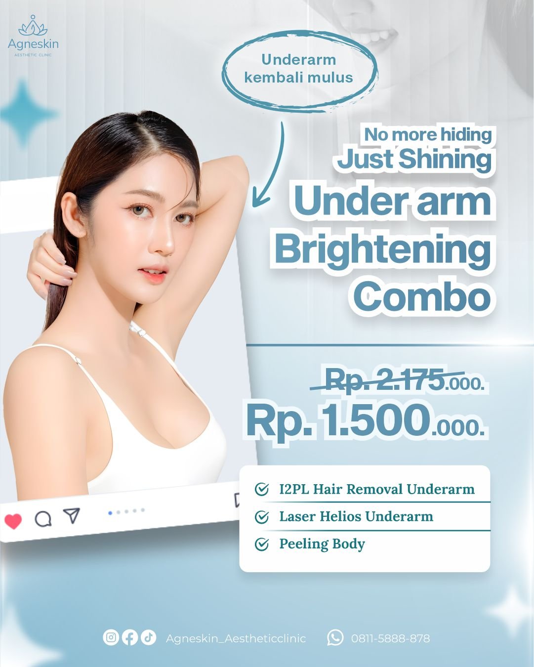 underarm