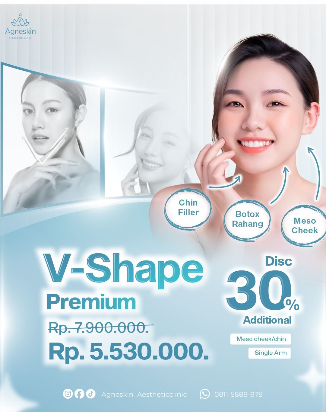 v shape