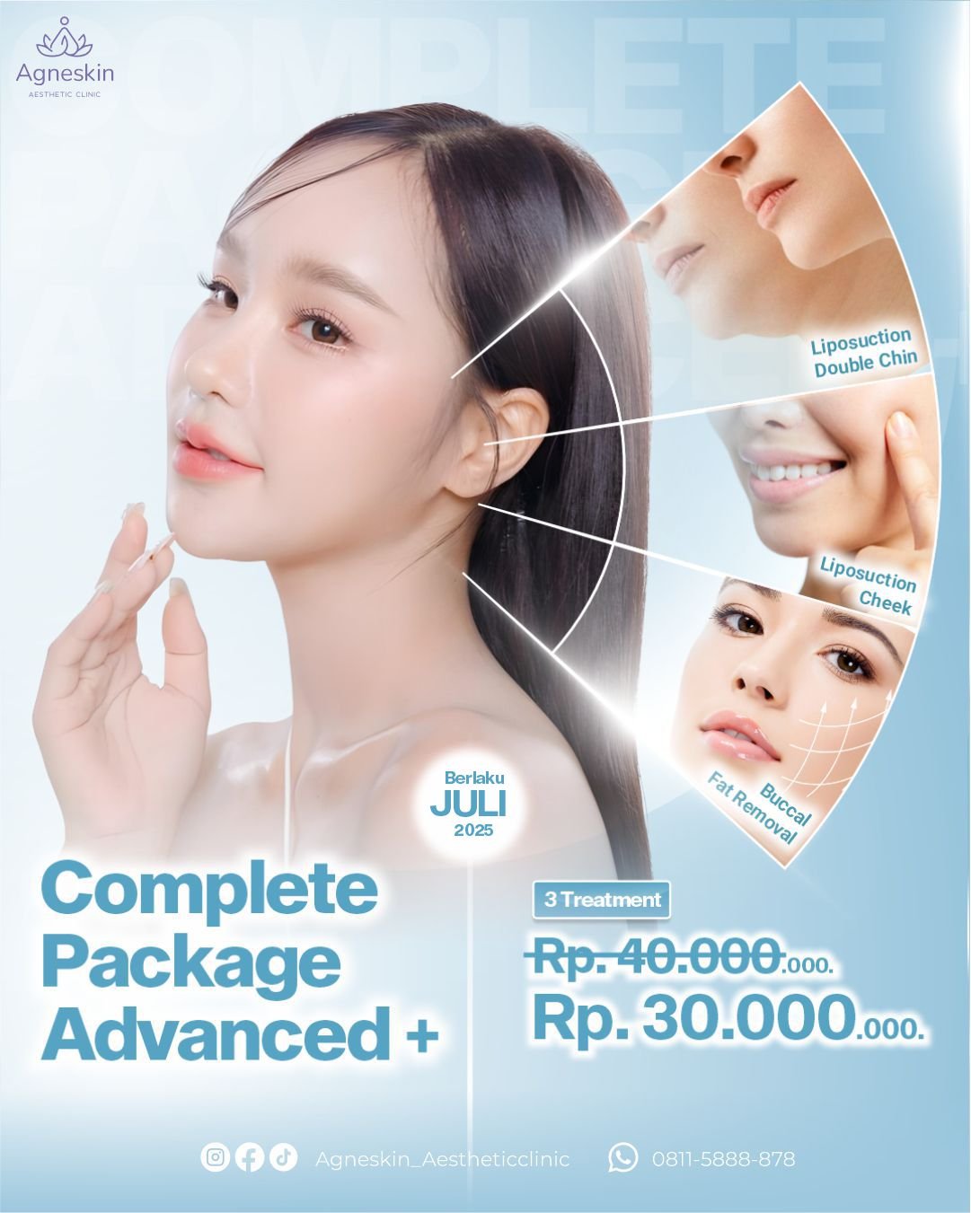 Promo Complete package