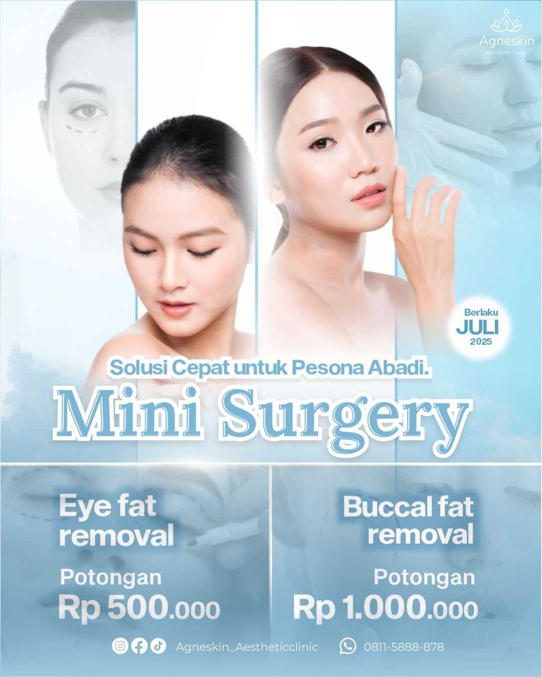 Promo Mini Surgery