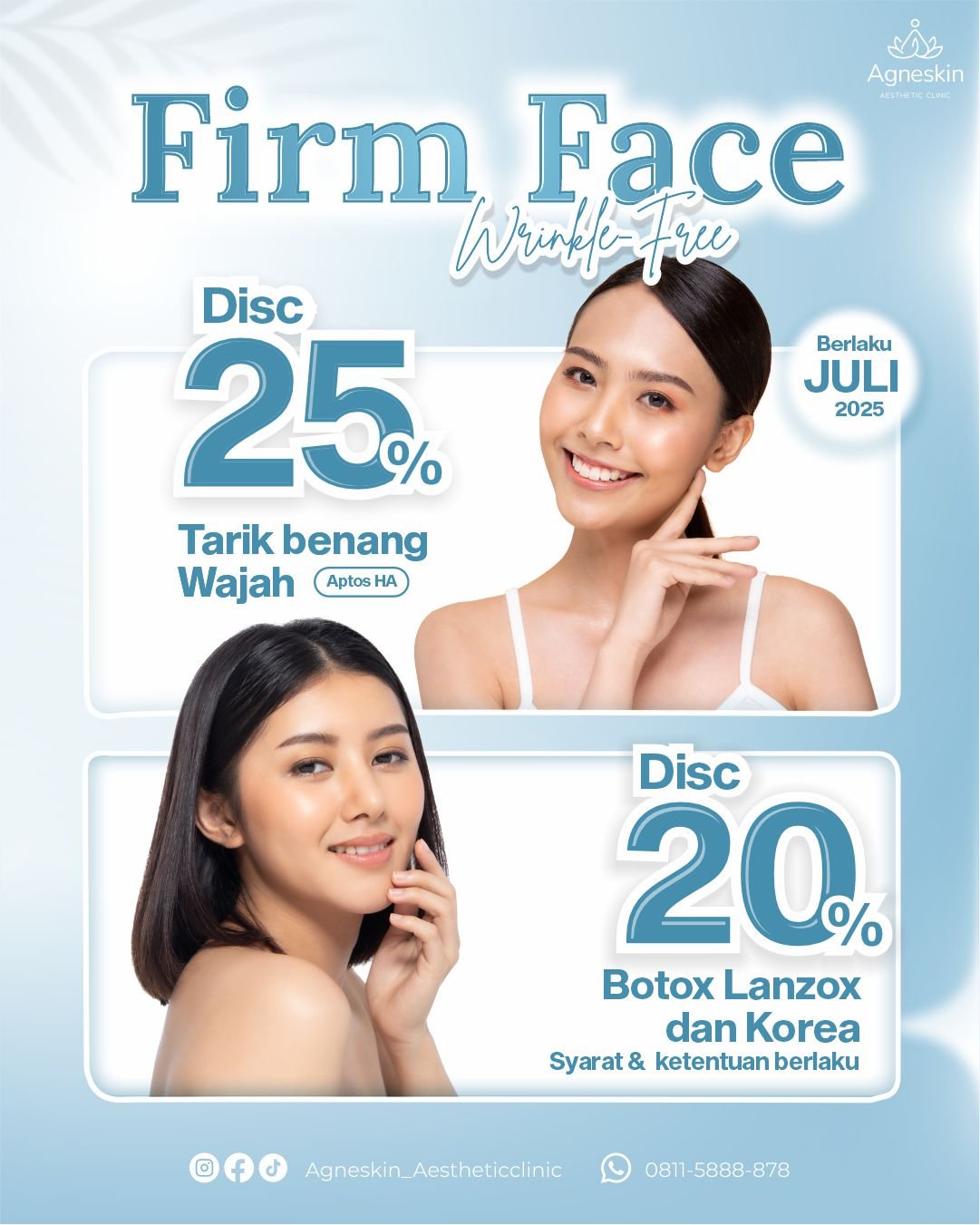 Promo Tarik benang dan botox
