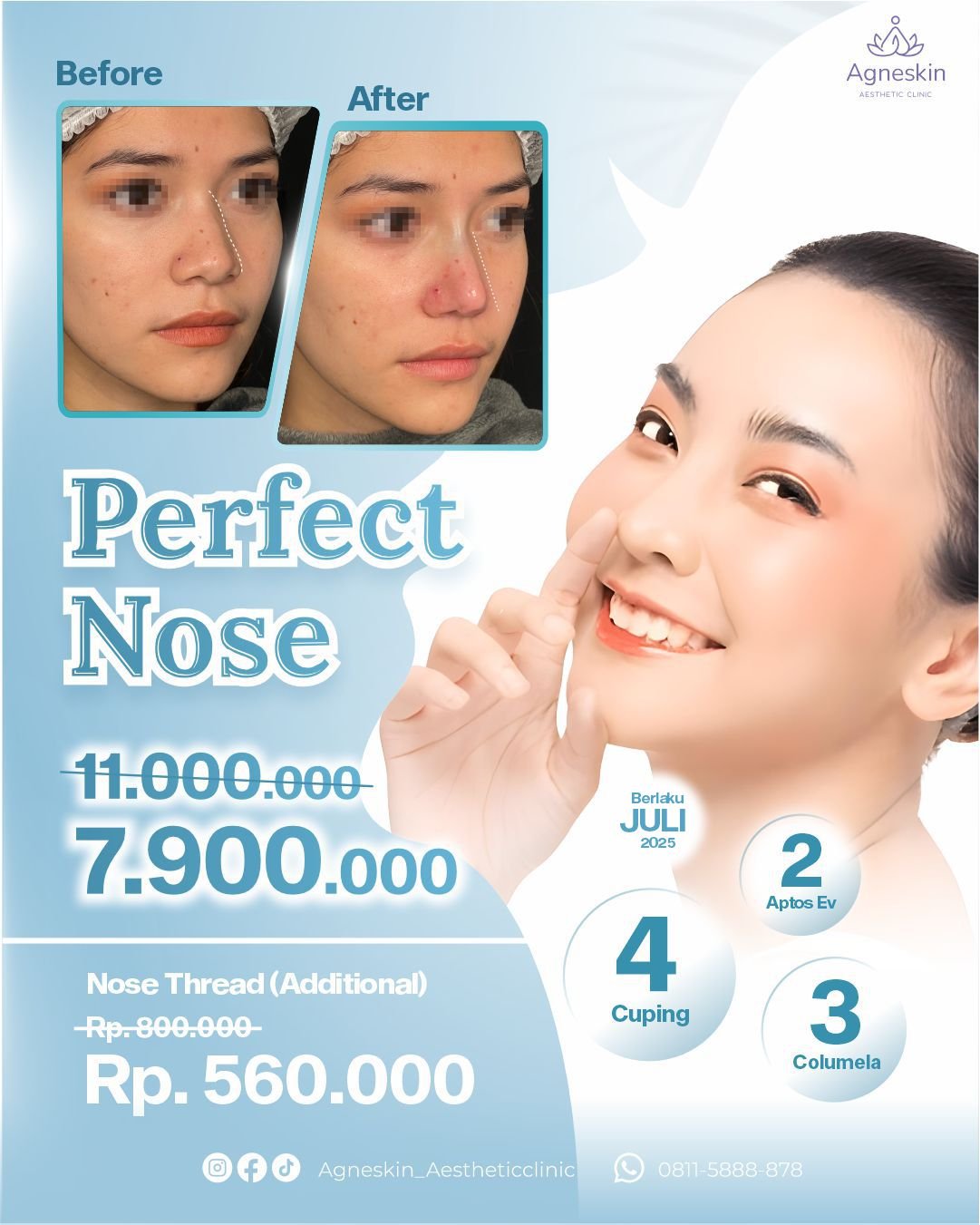 Promo perfect nose