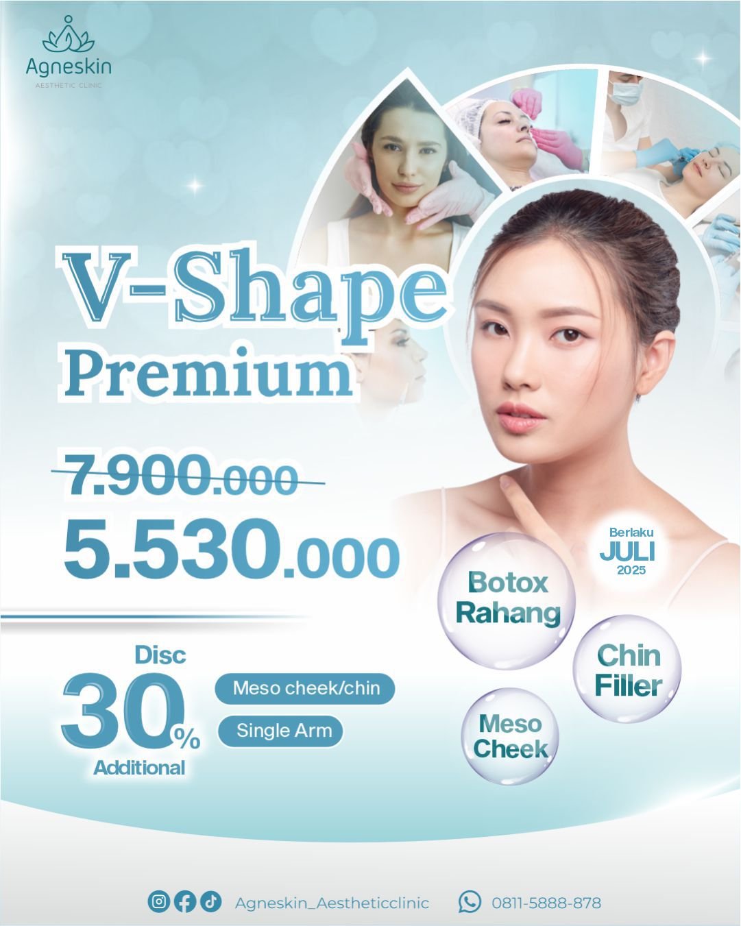 Promo v shape