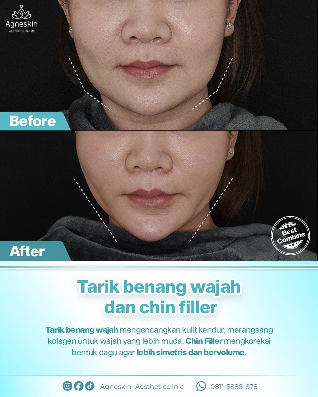 Agneskin-Feb-Better.jpg