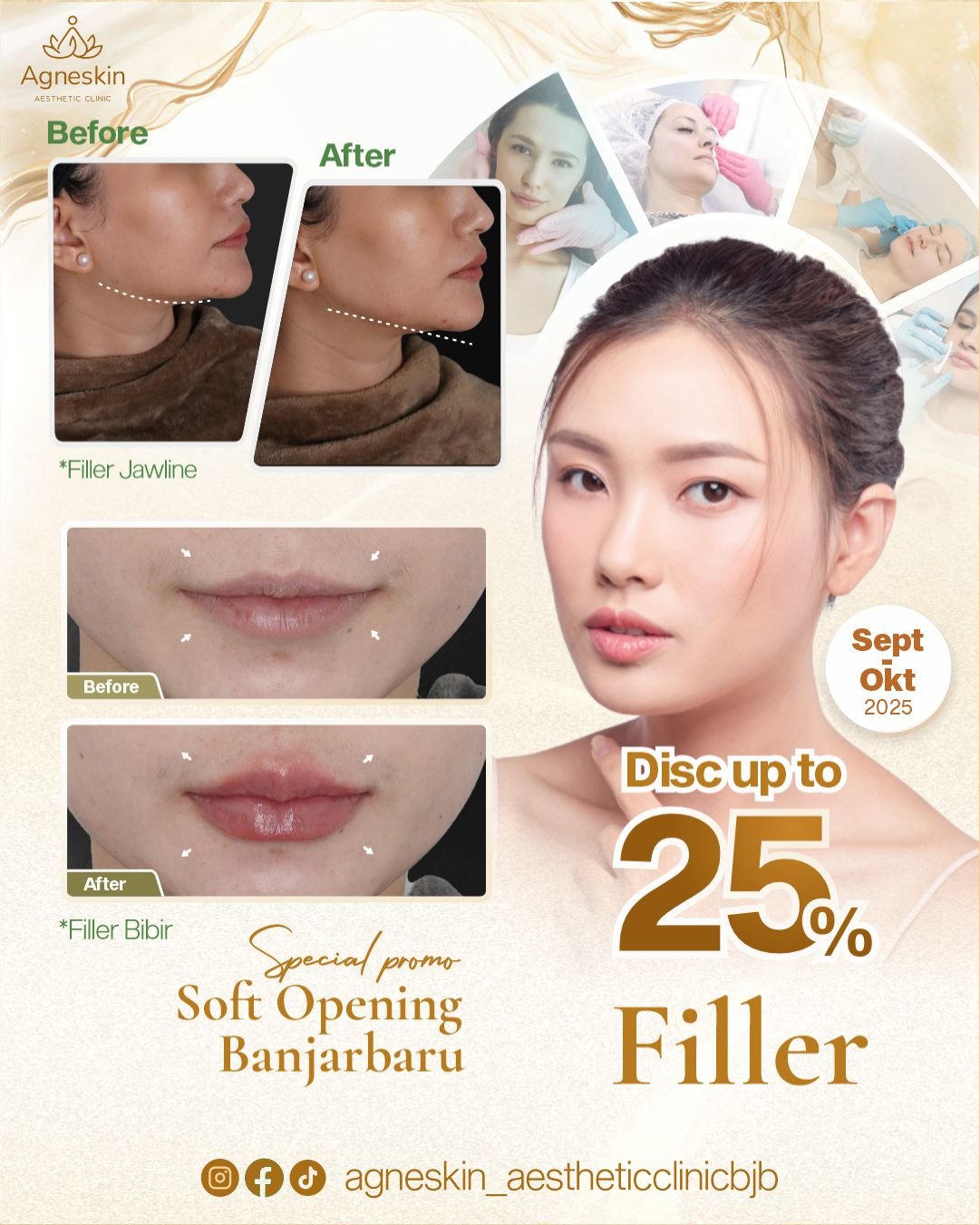 Filler bjb