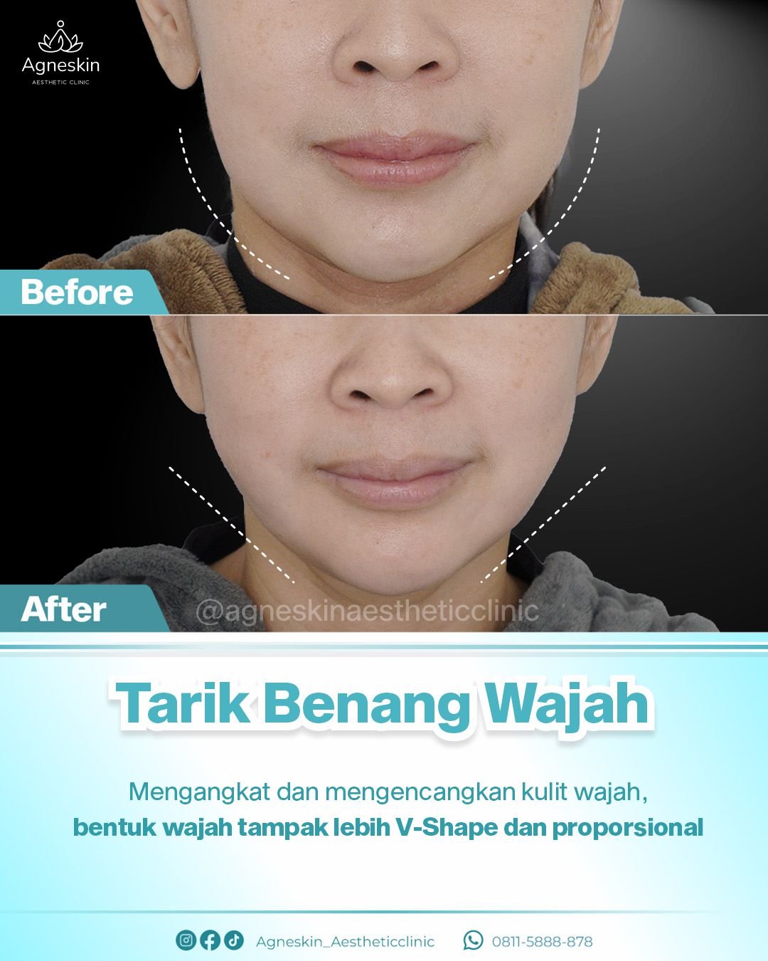 Tarik benang wajah