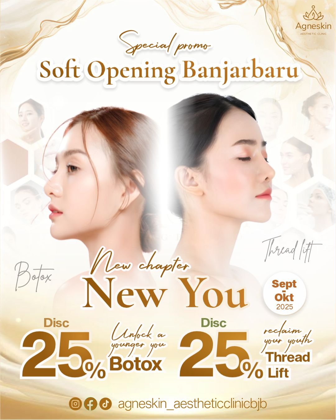 botox threadlift bjb