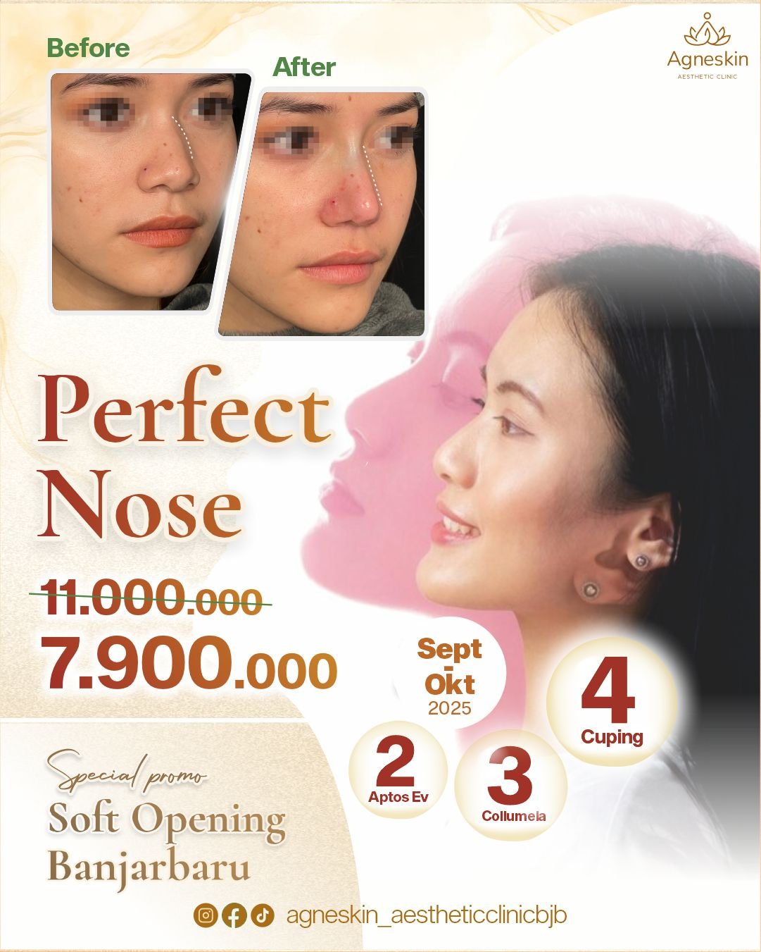 perfect nose bjb