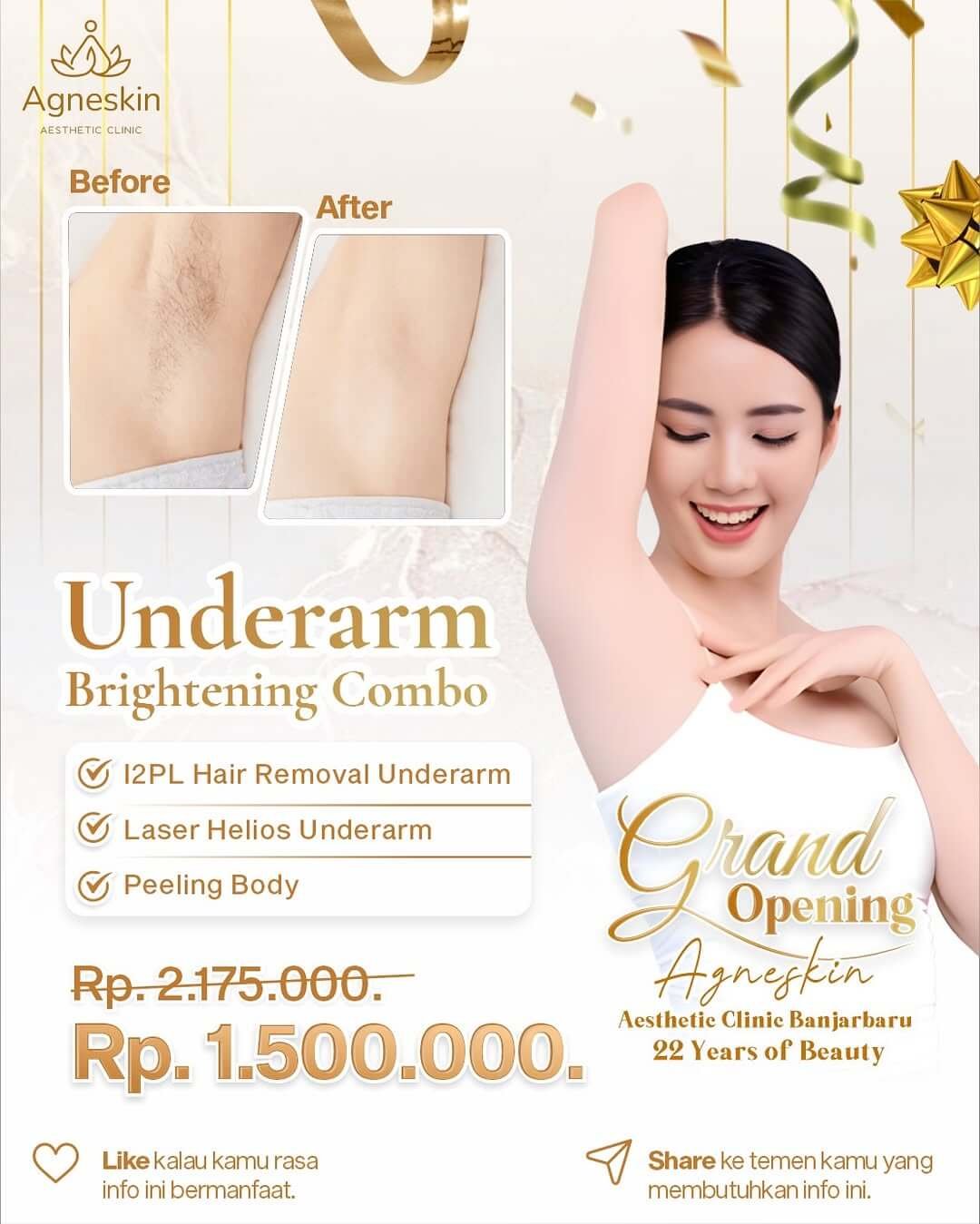GO Celebration Agneskin Banjarbaru is here! ✨ Nikmati promo gila-gilaan yang cuma ada selama per (1)