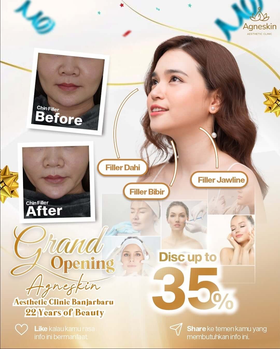 GO Celebration Agneskin Banjarbaru is here! ✨ Nikmati promo gila-gilaan yang cuma ada selama per (5)